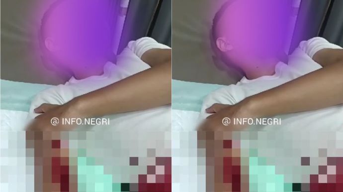 RAD (21), putra seorang anggota TNI Angkatan Darat, yang menjadi korban begal.