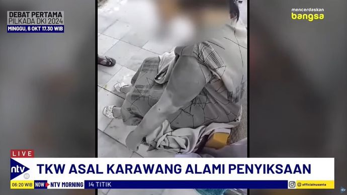 Nurlela, TKW asal Karawang, mengalami penyiksaan sadis di Arab Saudi. 