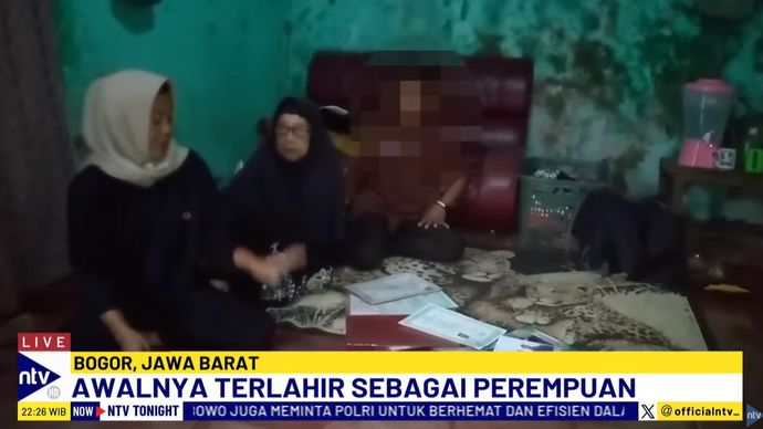 Seorang remaja berusia 14 tahun berinisial TAP memiliki kelamin ganda.