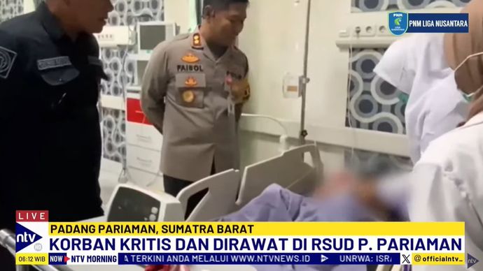 Bocah berusia 2 tahun menjadi korban penganiayaan dari ayah tirinya mengalami patah tulang pada kaki kiri. 