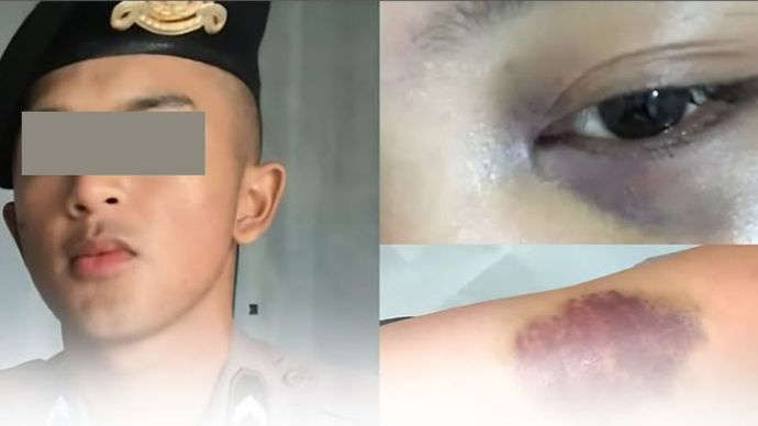 Oknum polisi diduga aniaya wanita