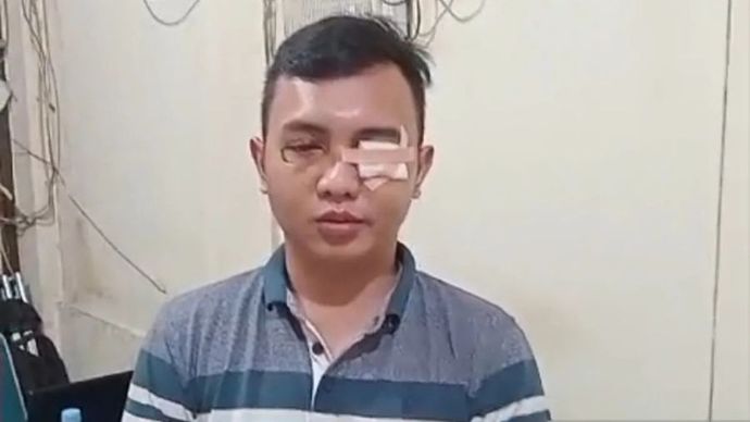 Anak Aparatur Sipil Negara (ASN) Kementerian Pertahanan (Kemhan) berinisial MSK (23) meminta maaf kepada para korban yang ditabraknya di Jalan Palmerah Barat II, Palmerah, Jakarta Barat, Kamis (30/1/2025).