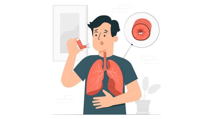 Ilustrasi - Pengguna Inhaler untuk penyakit Asma