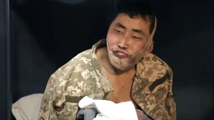 Ilustrasi dari Tangkapan layar seorang tentara yang terluka yang diduga warga Korea Utara dan ditangkap oleh pasukan Ukraina, terlihat dalam video yang diunggah Presiden Ukraina Volodymyr Zelenskyy melalui media sosial X.