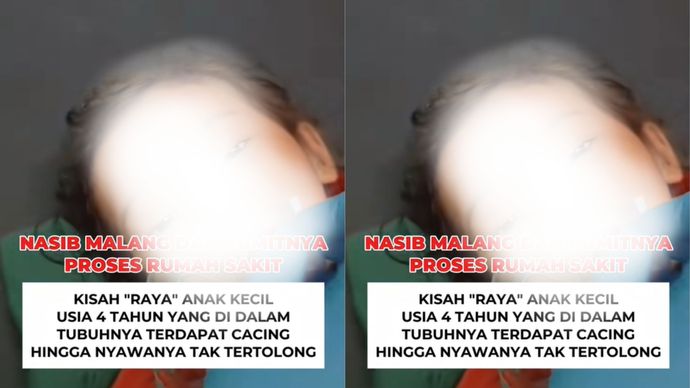 Raya Bocah Kecil yang Tewas Gegara Tubuhnya Digerogoti Cacing