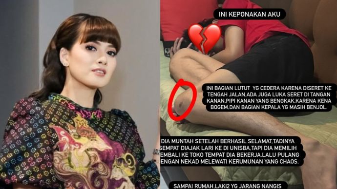Keponakan Chika Jessica jadi korban salah pukul oleh oknum aparat saat demo di Bandung