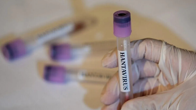 Ilstrasi - Hantavirus (7/5/2026). (ANTARA/Anadolu Agency/pri)