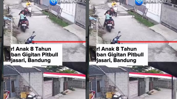 anak digigit pitbull