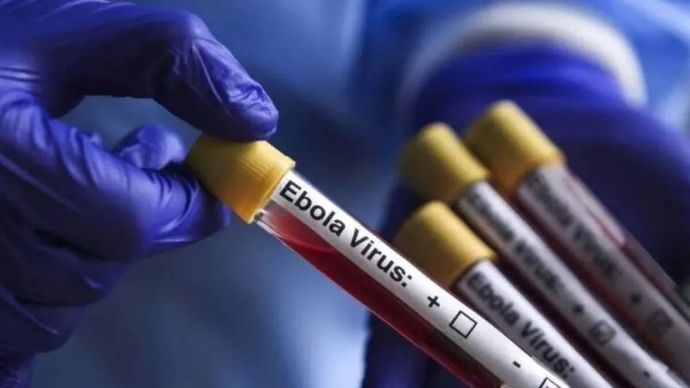 Ilustrasi - Virus Ebola terlihat di Ankara, Turkiye.