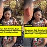 Heboh Beredar Video Bayi Cantik Didiagnosis Derita Craniosynostosis