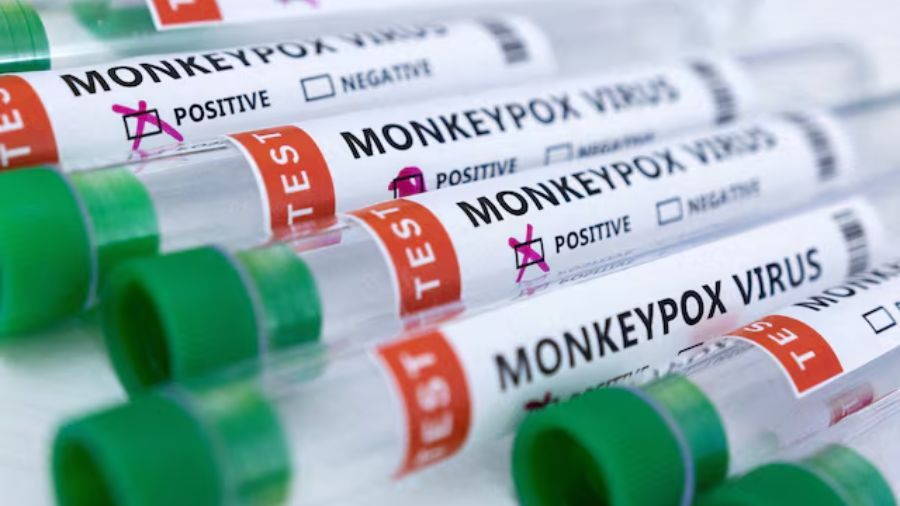 Monkeypox Virus <b>(Reuters)</b>