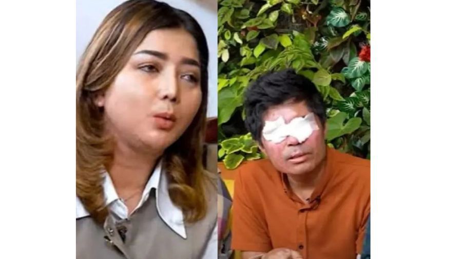 Agus Salim, seorang korban penyiraman air keras, melaporkan YouTuber Novi ke polisi, karena uang donasi senilai Rp1,5 miliar. <b>(Instagram)</b>