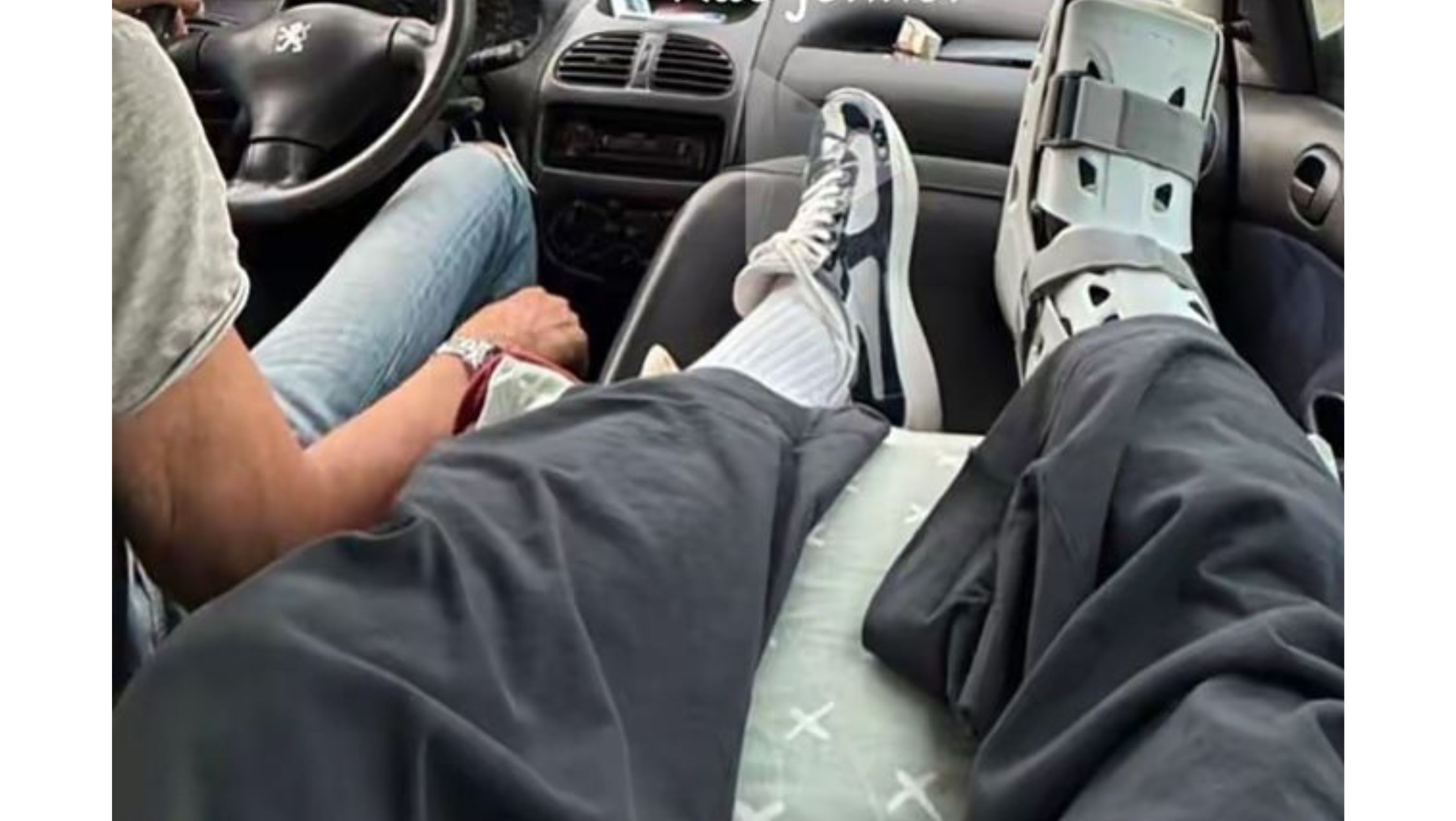 Kaki Ole Romeny yang cedera <b>(Instagram @oleromeny)</b>