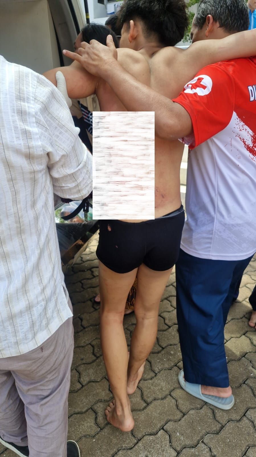 Salah satu korban luka di lokasi ledakan SMAN 72 Jakarta, Kelapa Gading, Jakarta Utara, Jumat, 7 November 2025.  <b>(Istimewa)</b>