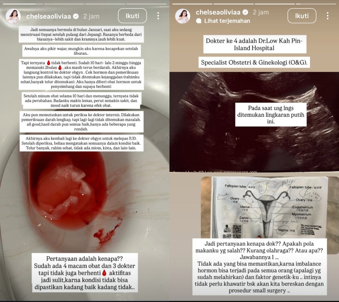 Gejala awal penyakit Chelsea Olivia  <b>(Instagram)</b>