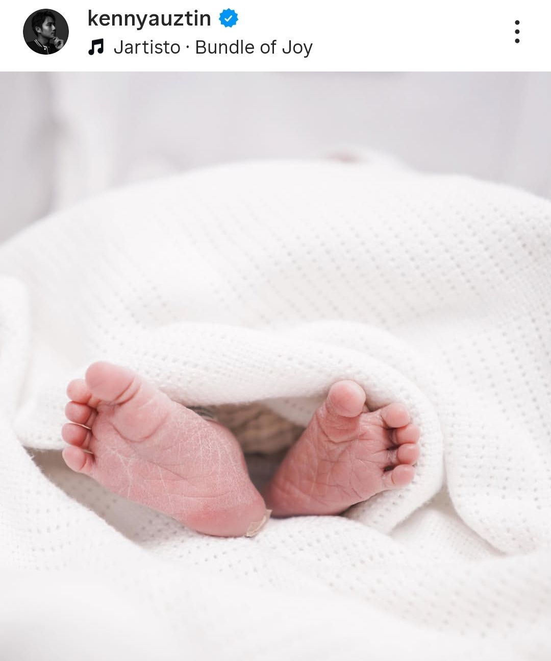 Anak pertama Kenny Austin dan Amanda Manopo lahir  <b>(Instagram)</b>