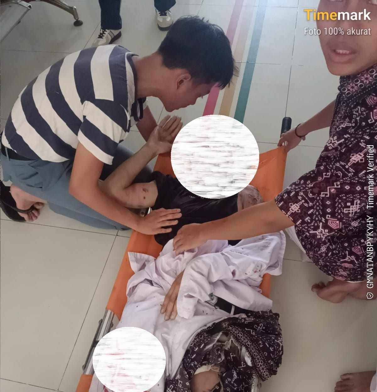 Salah satu korban luka di lokasi ledakan SMAN 72 Jakarta, Kelapa Gading, Jakarta Utara, Jumat, 7 November 2025.  <b>(Istimewa)</b>
