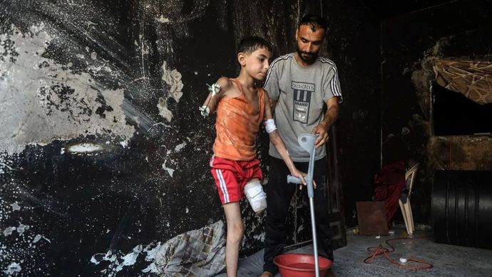 Samir Zaqout, 11 tahun, berjalan dengan dipapah anggota keluarganya di Kota Gaza, Palestina, Kamis, 14 Agustus 2025
