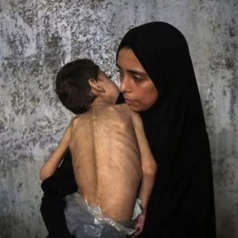 Korban Tewas Akibat Kelaparan di Gaza Capai 212 Jiwa, Hampir Separuhnya Anak-anak