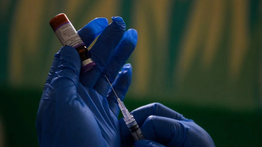 Kemenkes Terbitkan SE Kewaspadaan Campak, Tenaga Medis Diminta Perkuat Pencegahan