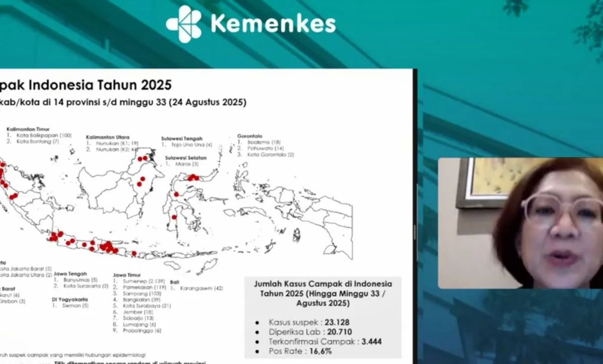 Tangkapan layar Direktur Imunisasi Kemenkes Prima Yosephine dalam konferensi pers mengenai penanganan kejadian luar biasa (KLB) campak, seperti dipantau di Jakarta, Selasa, 26 Agustus 2025. <b>(ANTARA)</b>