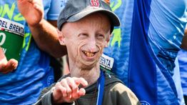 Sammy Basso Meninggal Dunia Usai Menderita Penyakit Progeria