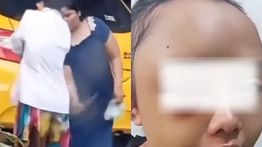Gadis Yatim Piatu Dianiaya Tantenya Hingga Babak Belur