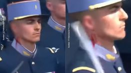 Viral Telinga Prajurit Prancis Berdarah Kena Pedang Sendiri saat Bastille Day