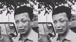 Sopir Ambulans Diduga Dikeroyok Saat Antar Pasien 