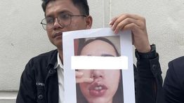 Dokter Gadungan di Pekanbaru Ditangkap, 15 Korban Alami Luka hingga Trauma