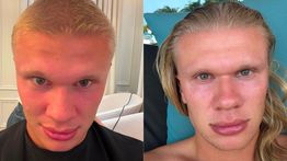 Potong Rambut, Erling Haalan Malah Seret Gol