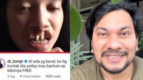 Rista Junianti kini tengah menjadi sorotan setelah memiliki suara merdu akan tetapi memiliki keterbatasan yaitu bibir sumbing.