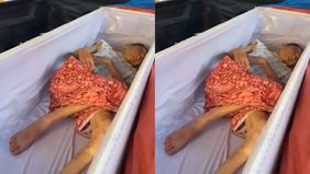 Sebuah kejadian mengejutkan terjadi di sebuah kuil di Thailand ketika seorang perempuan berusia 65 tahun yang sudah dinyatakan meninggal tiba-tiba menunjukkan tanda-tanda kehidupan beberapa saat sebelum proses kremasi dilakukan.