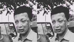 Seorang sopir ambulans bernama Muhammad Syamsudin menjadi korban pengeroyokan orang tak dikenal di Kecamatan Bengalon, Kabupaten Kutai Timur, Kalimantan Timur pada Selasa lalu, 6 Januari 2026, sekitar pukul 16.30 WITA.