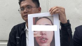 Kasus dugaan praktik medis ilegal oleh seorang dokter gadungan mencuat di Kota Pekanbaru. Seorang perempuan berinisial JRF atau Jenny Rahmadial Fitri diduga menjalankan praktik tanpa izin dengan mengaku sebagai dokter di klinik kecantikan Aurona Beau