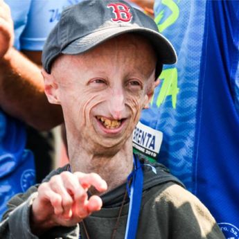 Sammy Basso Meninggal Dunia Usai Menderita Penyakit Progeria