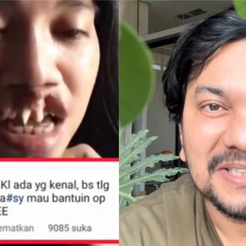 Dokter Tompi Bakal Kasih Operasi Plastik Gratis ke Rista Junianti yang Memiliki Suara Merdu