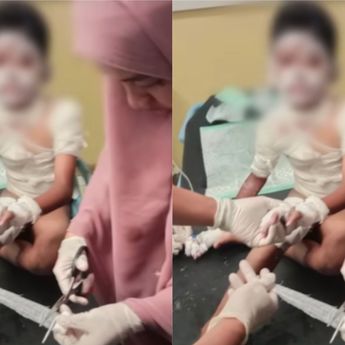 Kronologi Bocah SD 10 Tahun di Situbondo Dibakar Temannya Sendiri