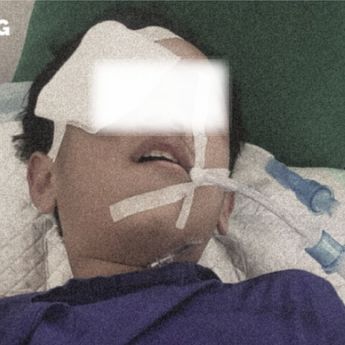 Viral Anak 11 Tahun Jadi Korban Penganiayaan Sadis di Cikarang