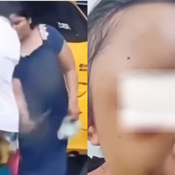 Gadis Yatim Piatu Dianiaya Tantenya Hingga Babak Belur