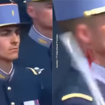 Viral Telinga Prajurit Prancis Berdarah Kena Pedang Sendiri saat Bastille Day
