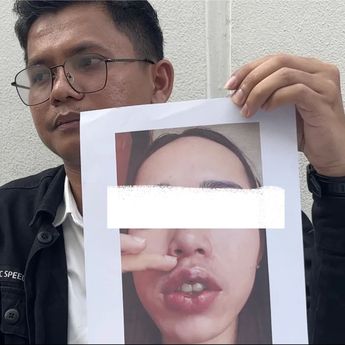 Dokter Gadungan di Pekanbaru Ditangkap, 15 Korban Alami Luka hingga Trauma