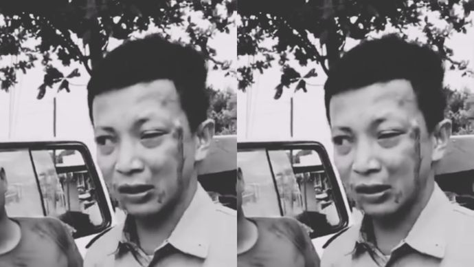 Viral Sopir Ambulans Diduga Dikeroyok OTK Saat Antar Pasien di Kutai Timur