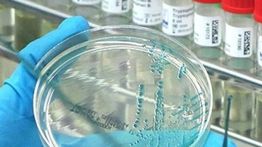Australia Catat Kematian Massal Satwa Akibat Flu Burung untuk Pertama Kalinya