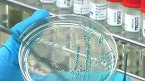 Kematian massal satwa liar akibat virus flu burung H5 yang mematikan akhirnya menembus pertahanan alam Australia. 