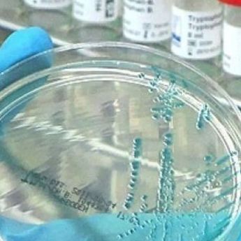 Australia Catat Kematian Massal Satwa Akibat Flu Burung untuk Pertama Kalinya