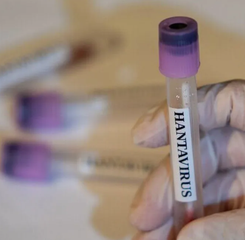 Hantavirus Dilaporkan Menyebar di Kalangan Militer Ukraina, Begini Kondisinya