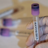 Hantavirus Dilaporkan Menyebar di Kalangan Militer Ukraina, Begini Kondisinya