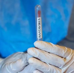 CDC: Virus Andes Satu-satunya Hantavirus yang Bisa Menular Antar-Manusia