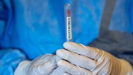 CDC: Virus Andes Satu-satunya Hantavirus yang Bisa Menular Antar-Manusia